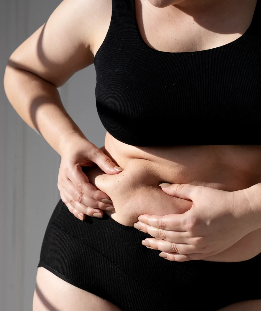 abdominoplasty surgery