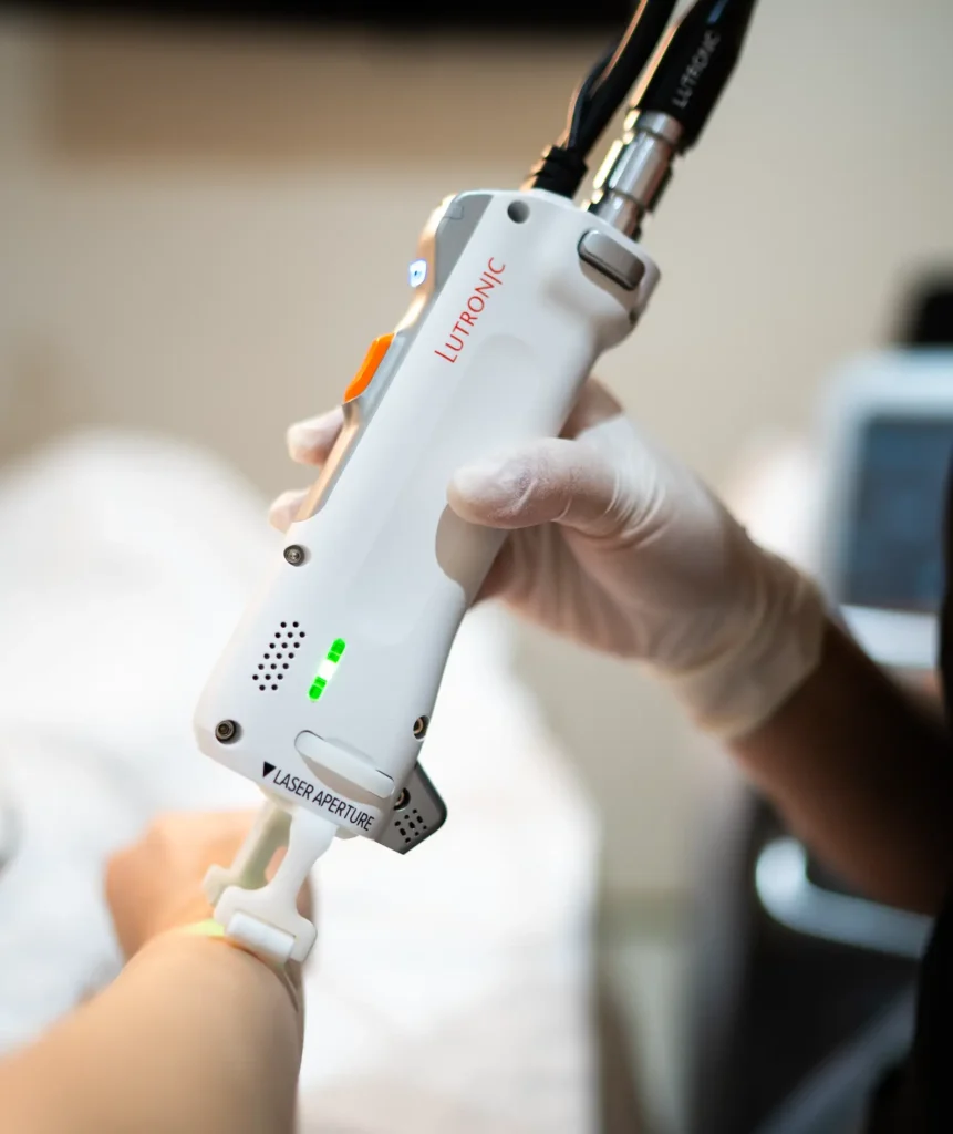 laser hair removal treatment machine