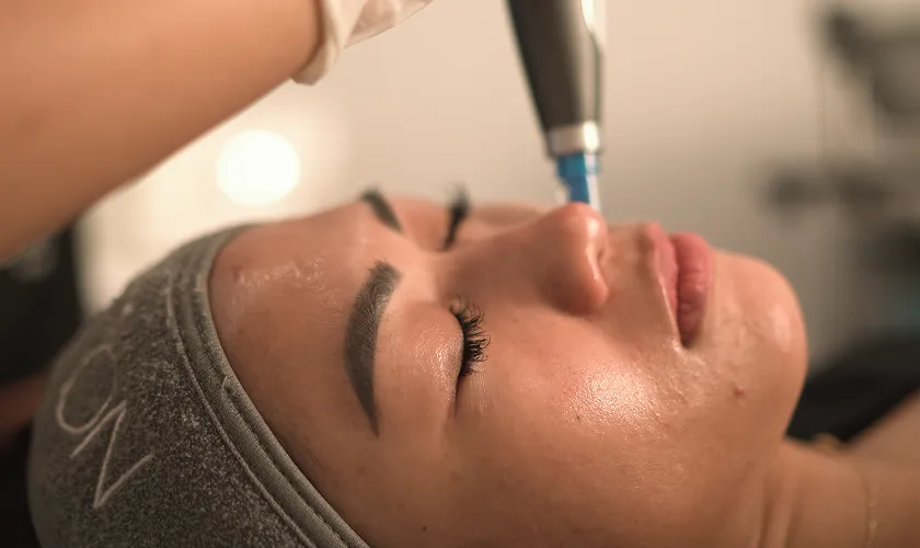 Dermapen Mesofacial