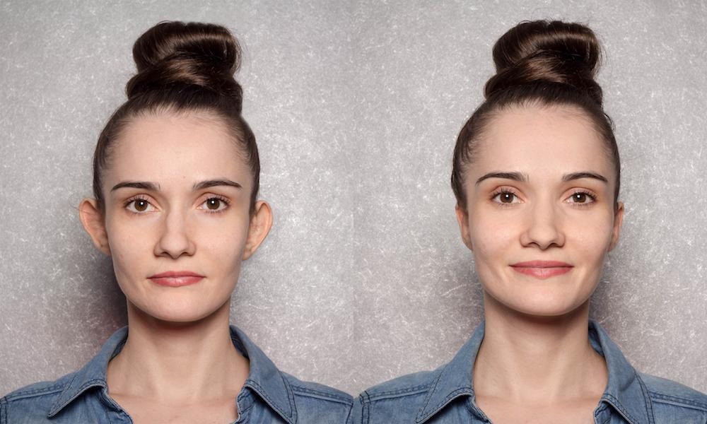All You Need to Know About Otoplasty