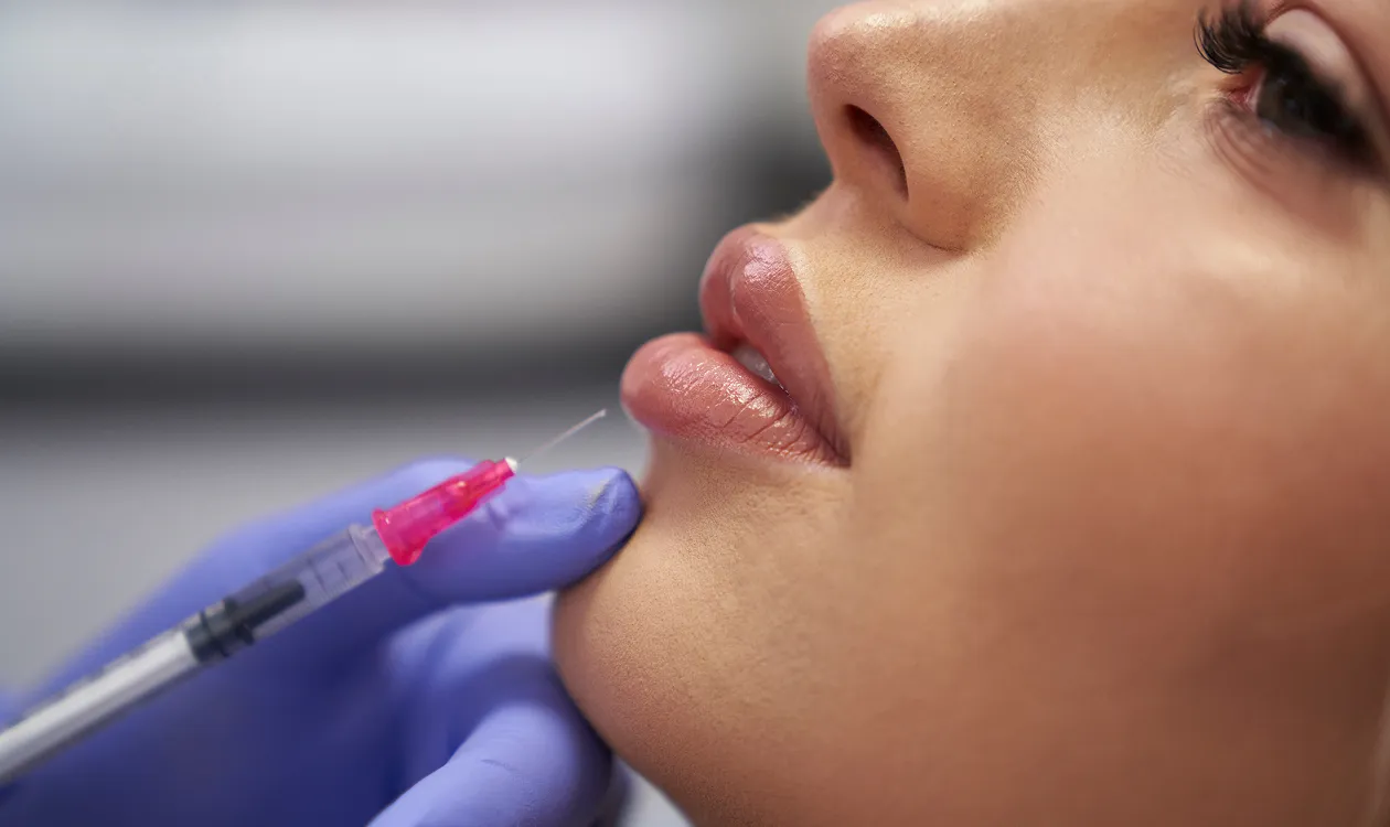 Lip Fillers