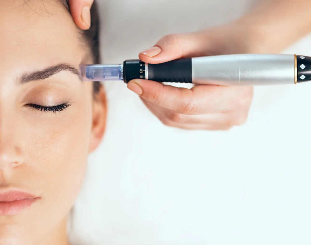 Mesotherapy for Face Pigmentation in Dubai at Nova Clinic