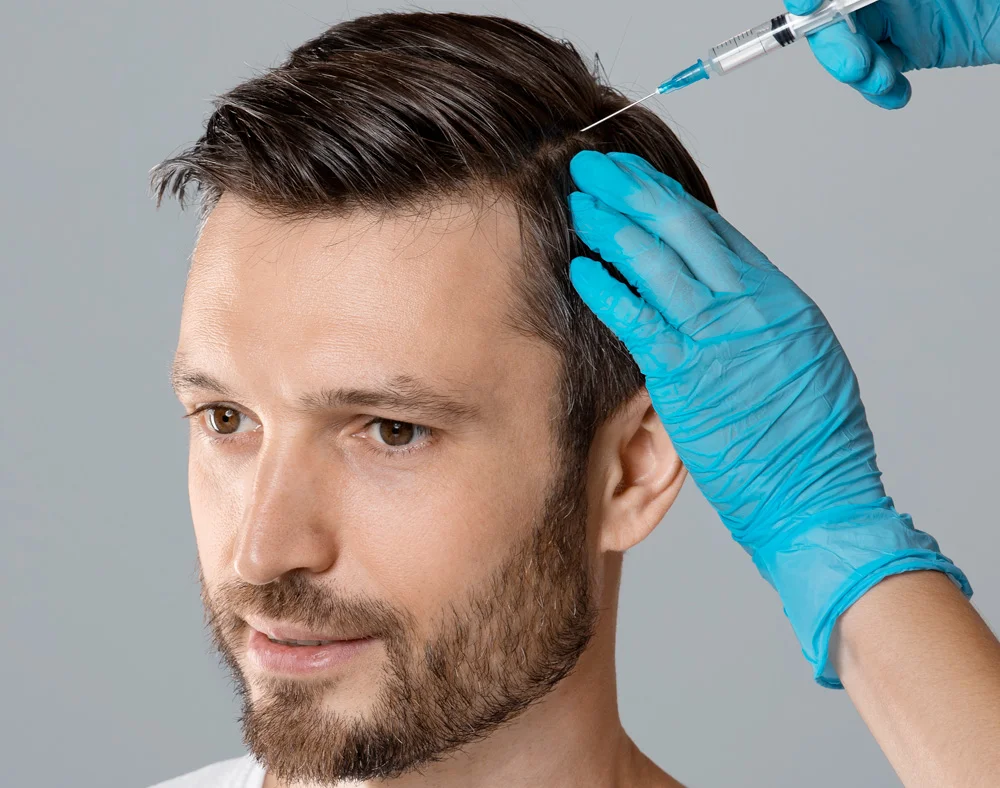 Mesotherapy treatment for Hair Loss in Dubai at Nova Clinic