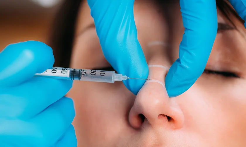 Nose Fillers