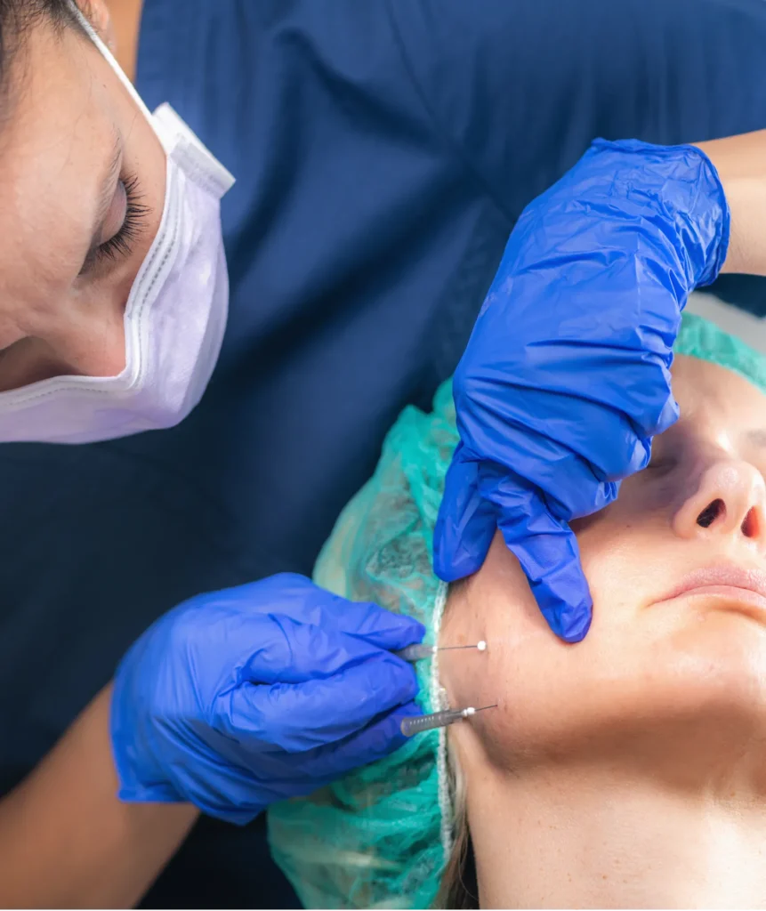 Thread Lift Dubai at Nova Clinic