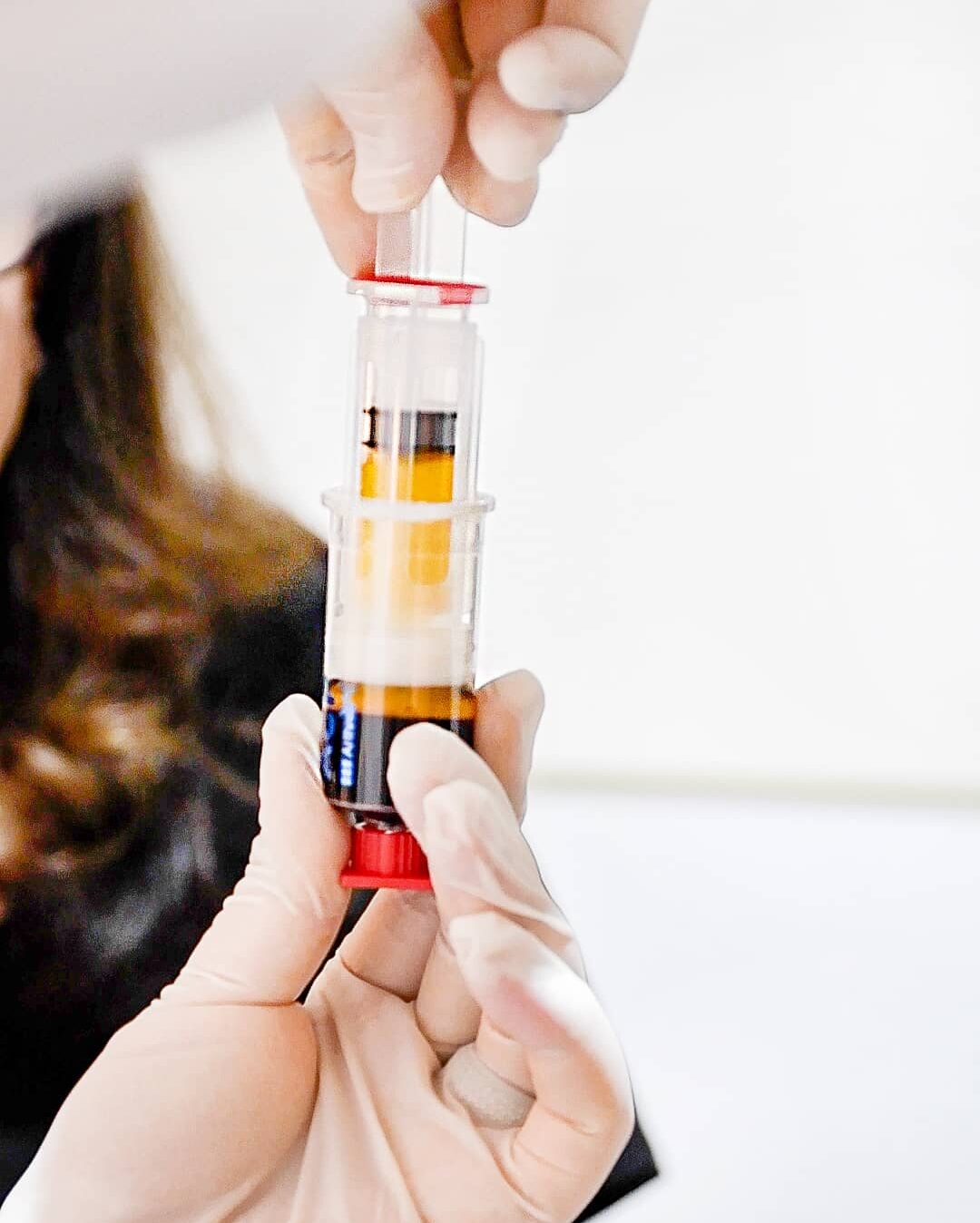 A Comprehensive Guide to PRF Injections for Cosmetic Enhancement