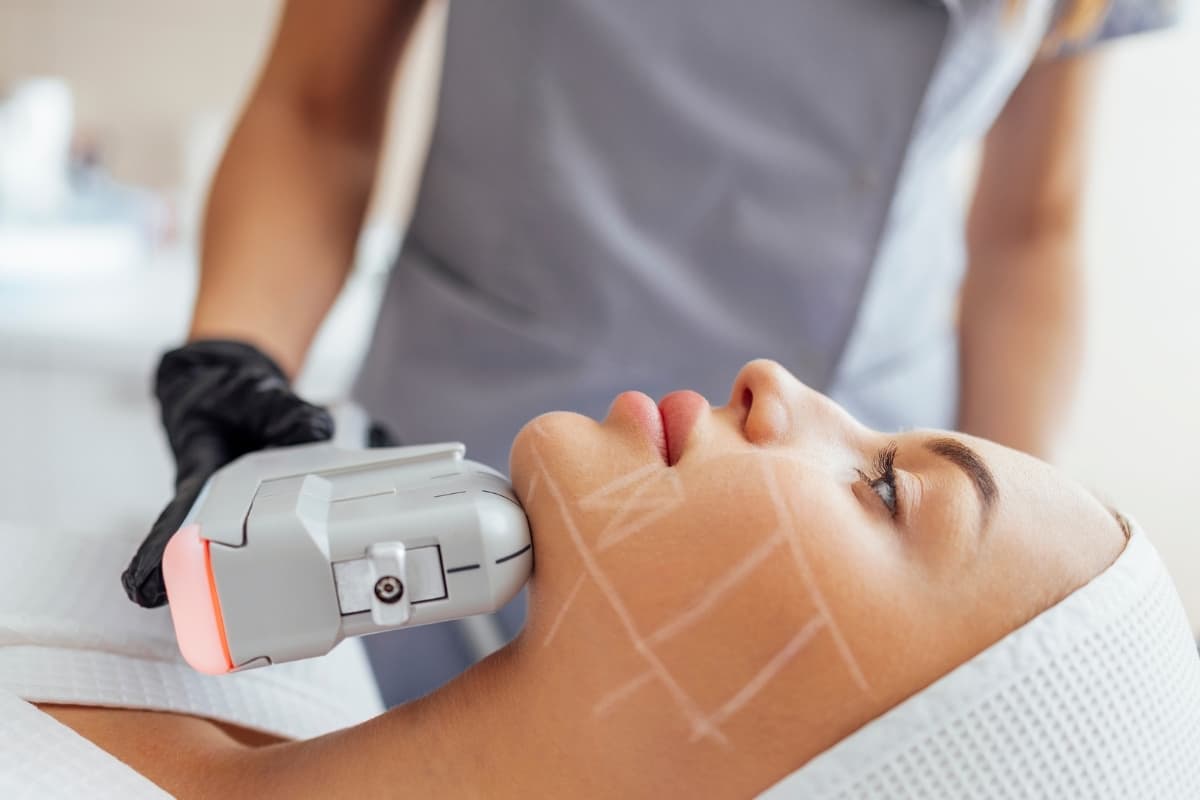 Experience Youthful Glow with Non-surgical Facelift - HIFU (High-intensity Focused Ultrasound)