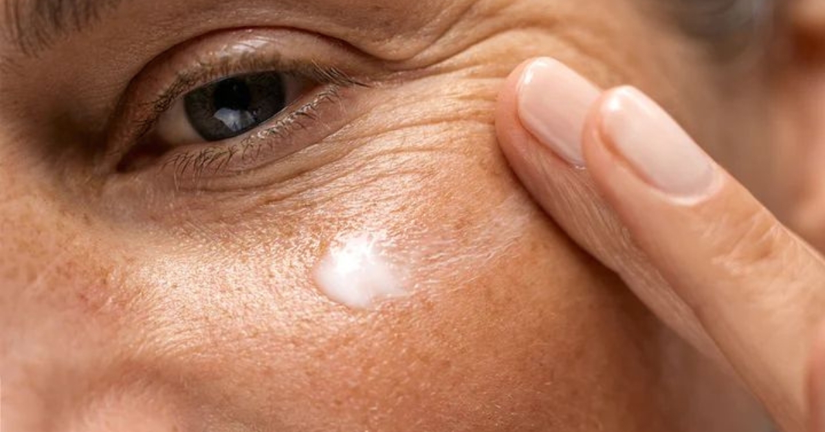 How to Remove Pigmentation from Face: A Complete Guide