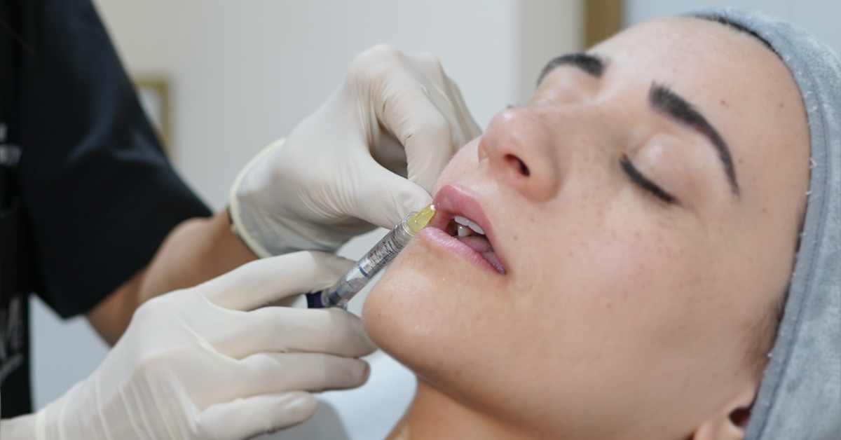 Thin Lips: Achieve Natural-Looking Fullness with Lip Fillers