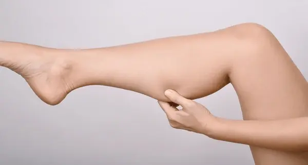 thigh-liposuction