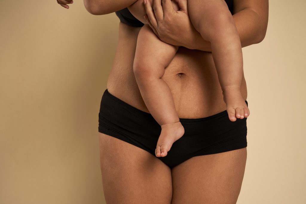 Is a Mommy Makeover Right for Me